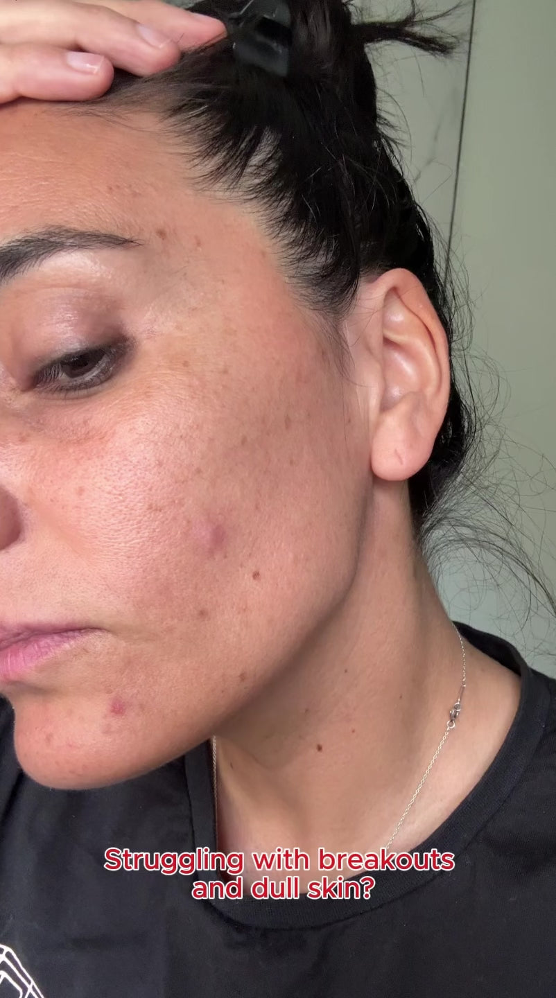 Load and play video in Gallery viewer, Glycolic Acid Toner with 7% Glycolic Acid(177 ml.)