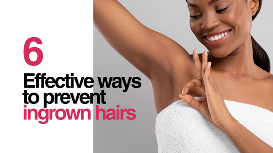 Conquer the Bumps: 6 Effective Ways to Prevent Ingrown Hairs