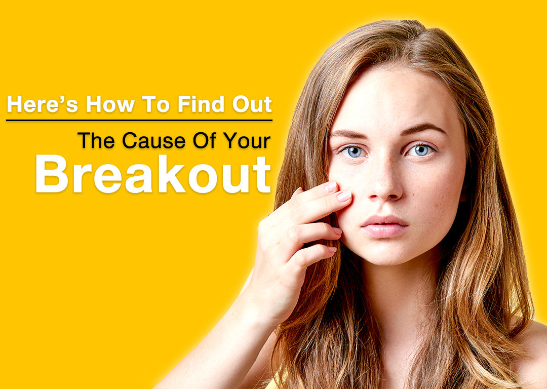 Here’s How To Find Out The Cause Of Your Breakout