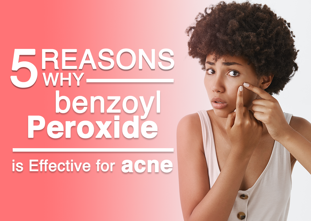 5 Reasons Why Benzoyl Peroxide is Effective for Acne – Touch Skin Care
