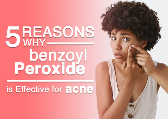5 Reasons Why Benzoyl Peroxide is Effective for Acne