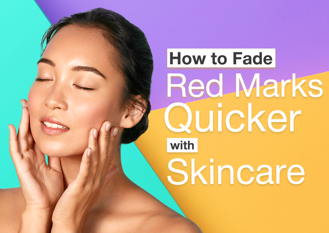 How to Fade Red Marks Quicker with Skincare