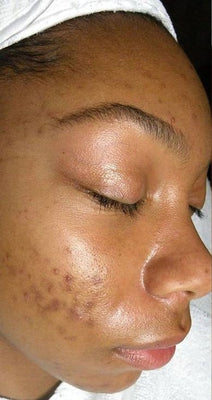 Before - Jessica M.