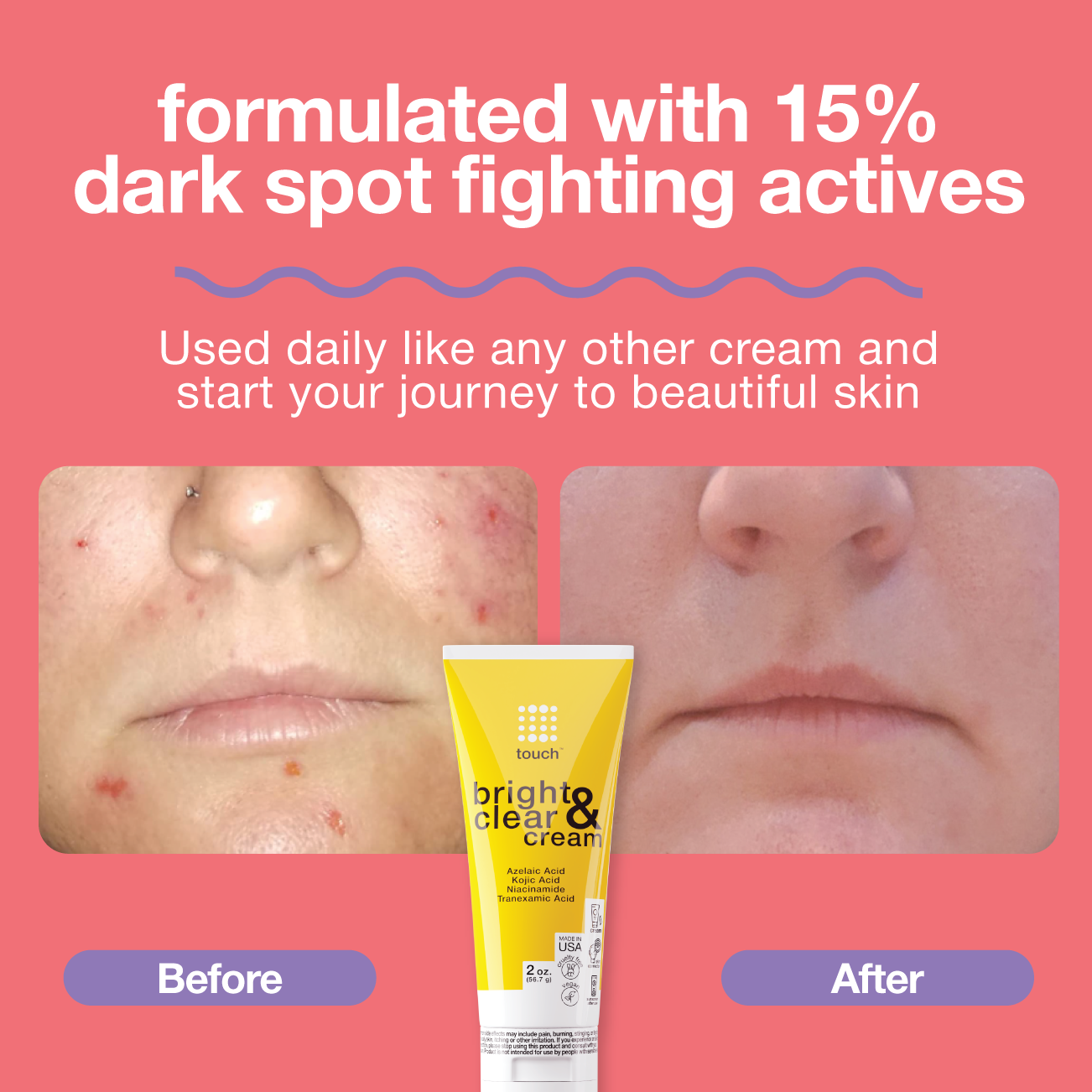 Bright & Clear Cream Two Pack for Dark Spots
