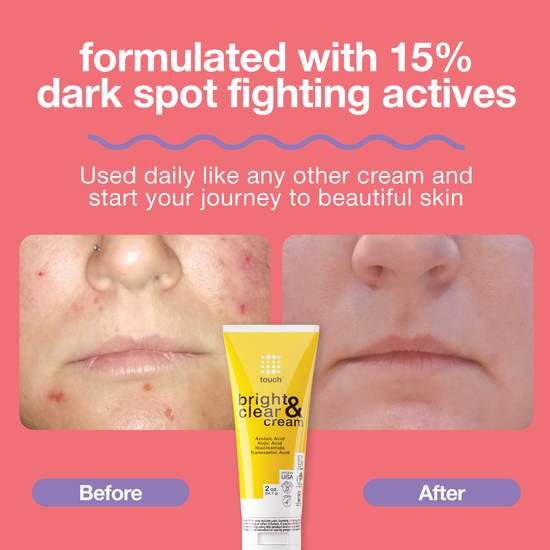 Bright & Clear Cream Two Pack for Dark Spots